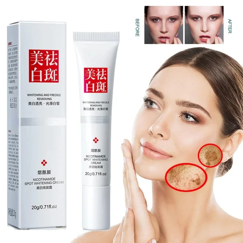 Выцветание и улучшение веснуше – обзор и цена Skincare Glow